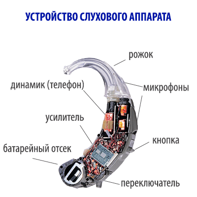 устройство слухового аппарата